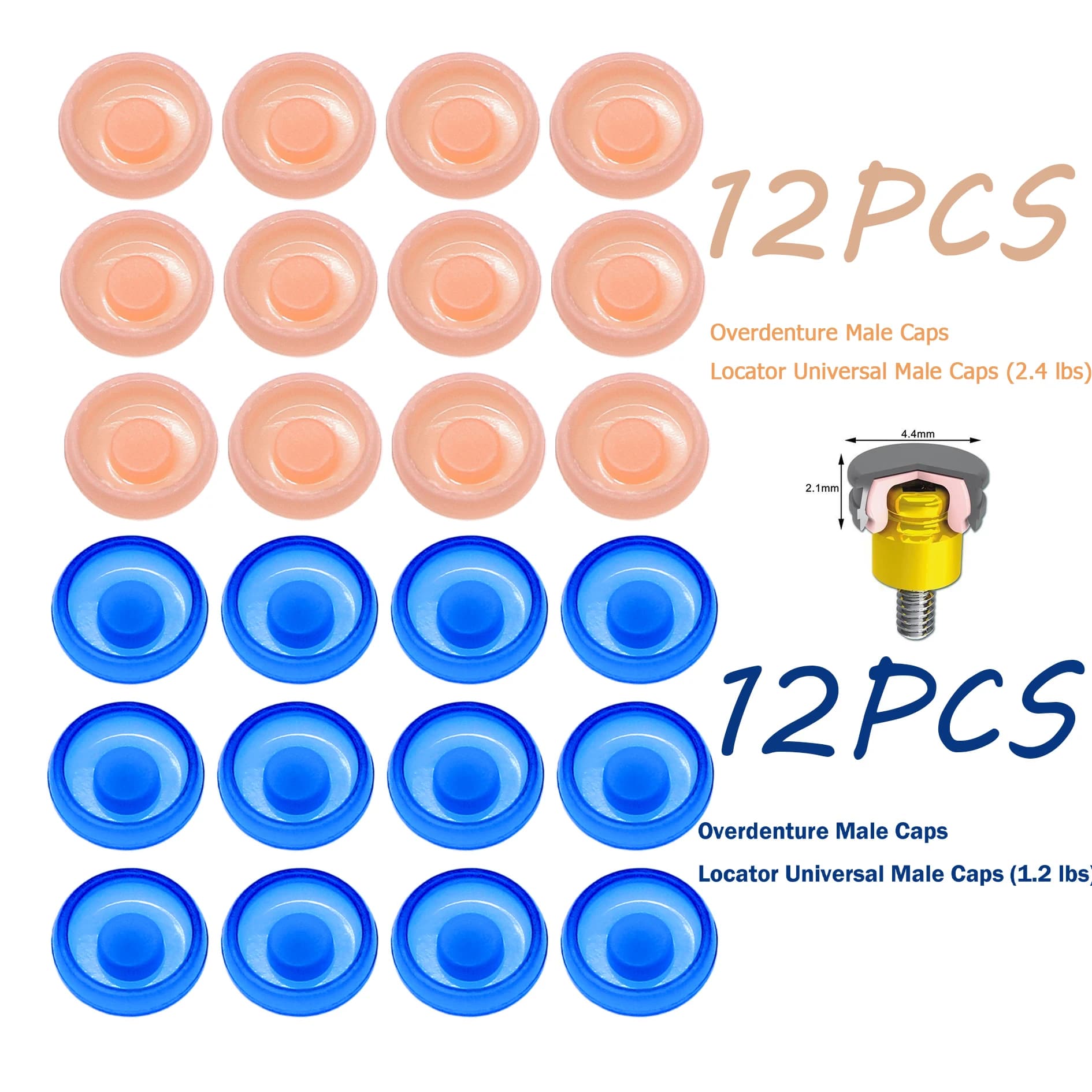 Dental Implant Retention Caps 1.2lbs/2.4lbs Removable Universal Locator  Abutment Overdenture Attachment Kit