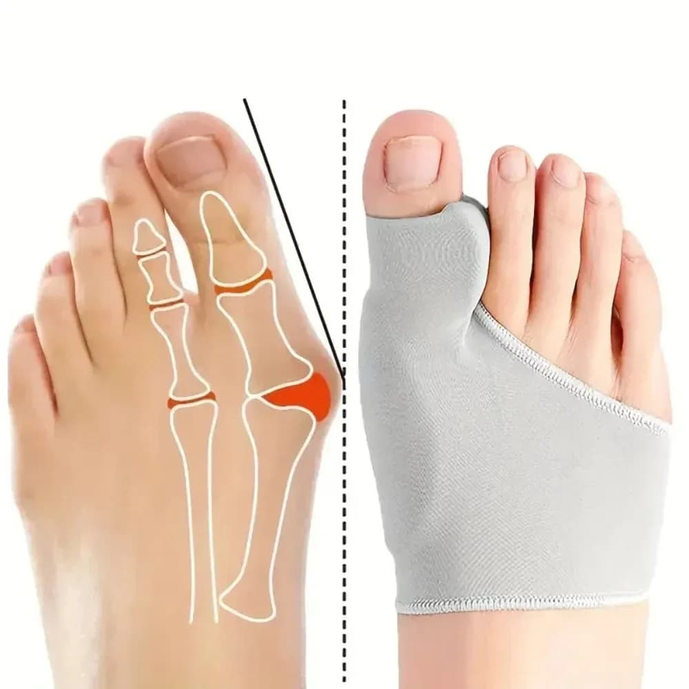 1Pair Toe Separator Bunion Corrector Toe Brace Orthopedic Hallux Valgus Relief Bone Thumb Adjuster Correction for Men and Women