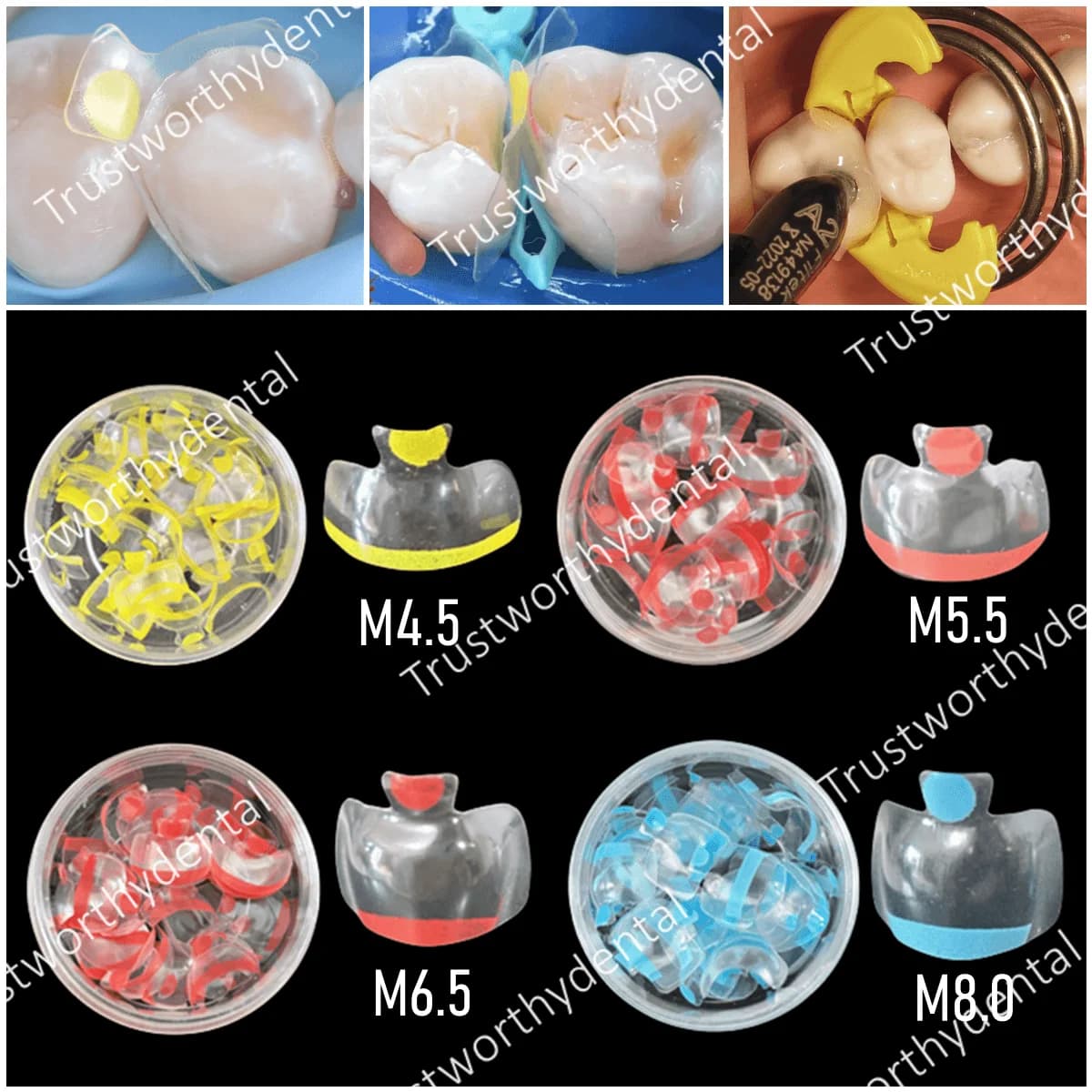 Dental Clear Matrix Posterior Fits Bioclear Transparent BT Matrices Molar Composite Class Restorative 4.5/5.5/6.5/8.0 0.038mm