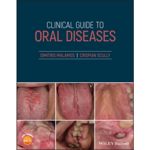 Clinical Guide to Oral Diseases (häftad, eng)