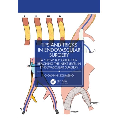 Tips and Tricks in Endovascular Surgery (häftad, eng)